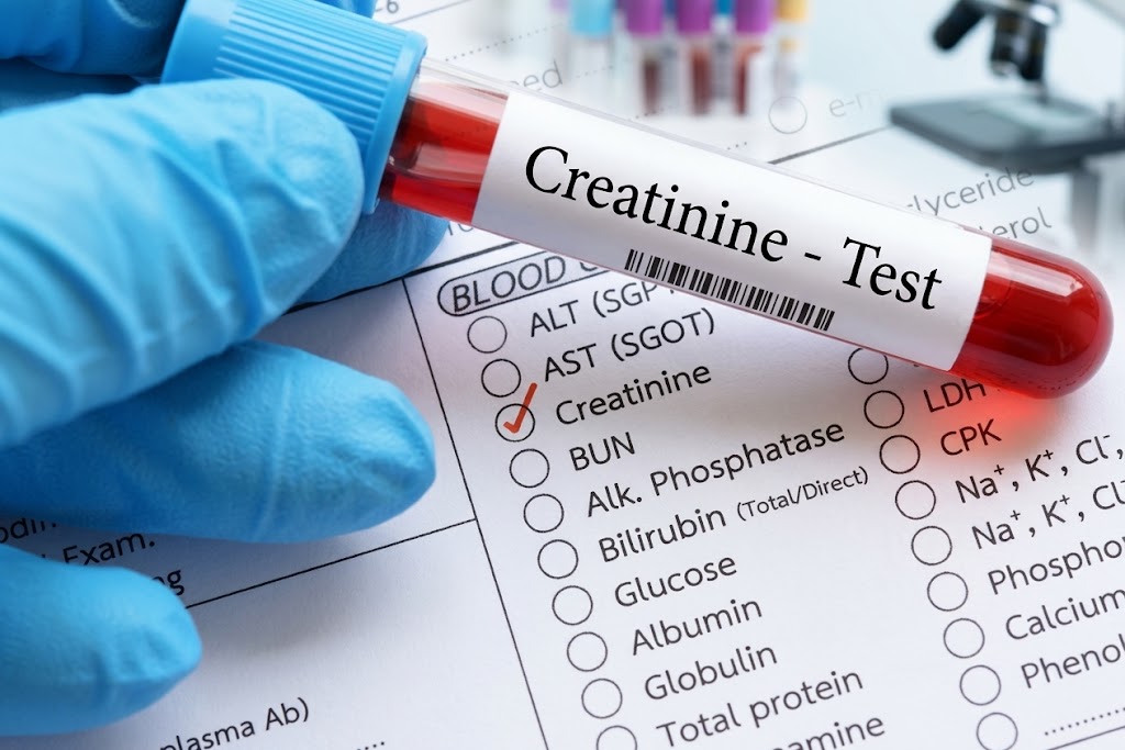 Serum Creatinine