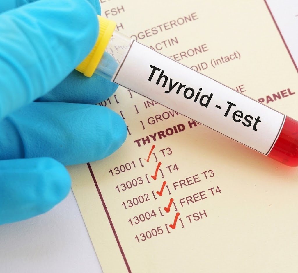 Thyroid Profile (TSH, T3, T4)