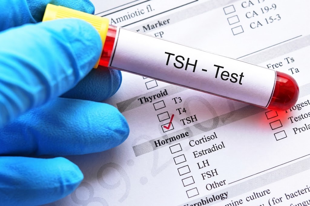 TSH